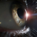 Laser,Vision,Correction,Concept.,Female,Eye,On,Surgery,Clinic,Exam