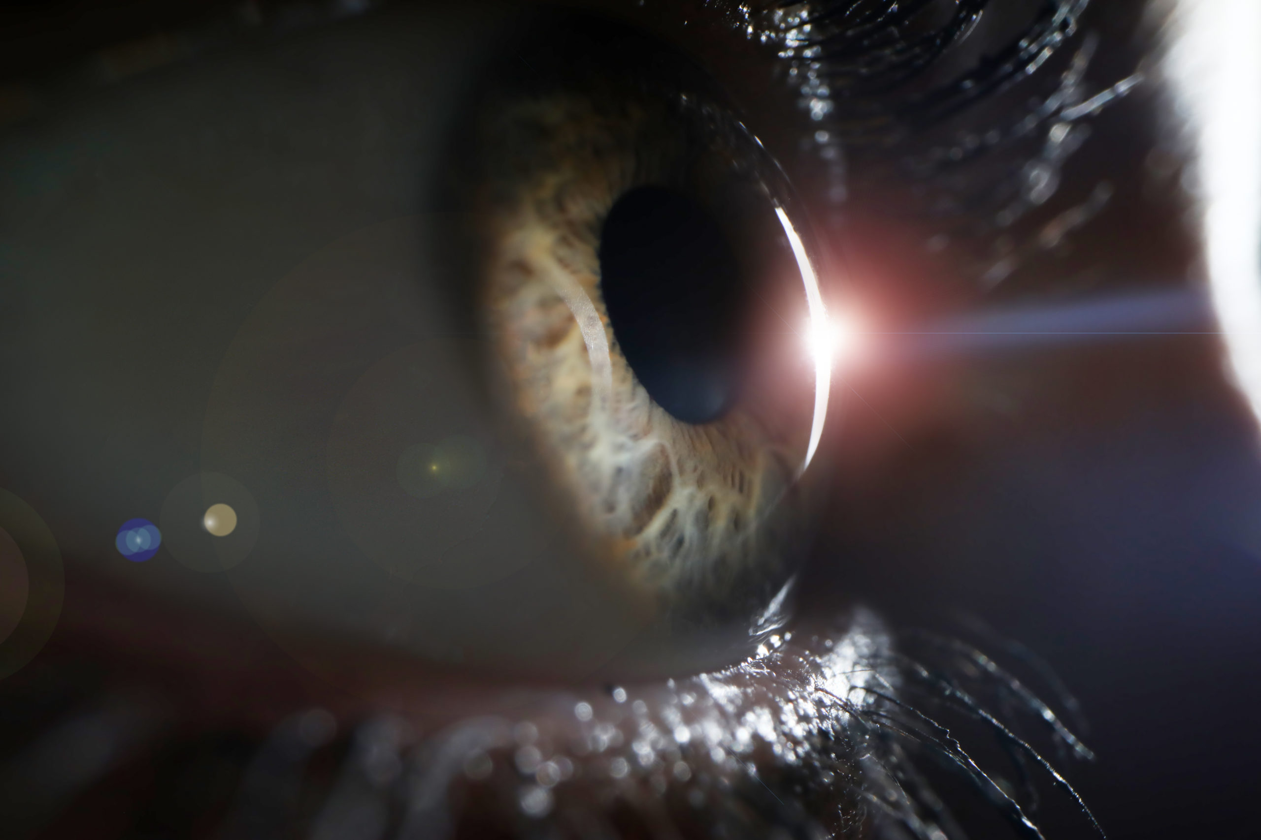 Когда после замены хрусталика восстанавливается зрение глаза. Сетчатка глаза. Ультрафиолетовое излучение на глаза.